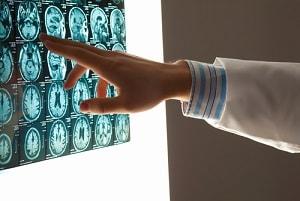 Rockford brain injury attorneys